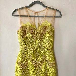 Gorgeous Neon Yellow Lace Dress